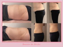 ボーテドリッシュ(Beaute de Riche)の雰囲気（ご予約殺到中リピ率◎凄腕腸もみ師の【腸もみ】1回のBAがスゴイ）