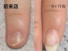 グレースレディ/