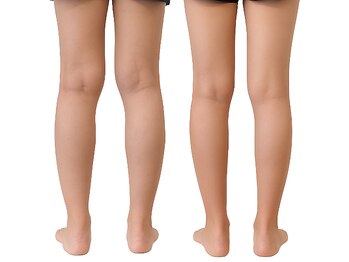 ベンザイ 梅田店(BENZAI)/足のむくみが気になる