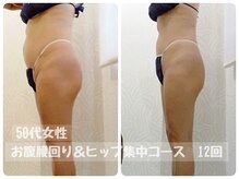 ピーエフ トウキョウ(PF TOKYO)の雰囲気(気になるセル脂肪をしっかり削ぎ落しメリハリBODY!本気痩せ応援)