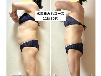 ヨサパーク ボニータ(YOSA PARK BONITA)