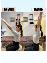 クオリア整骨院/痛みで手が上がらない・頭痛