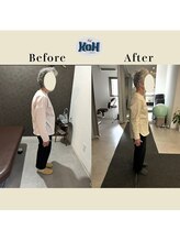 とくしま整体院 康/姿勢の変化