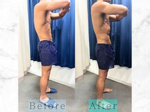 パラディ(PARADIS)/ハイパーナイフ