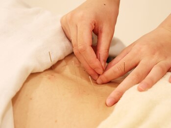 きらり整体 今福鶴見院/【鍼灸】