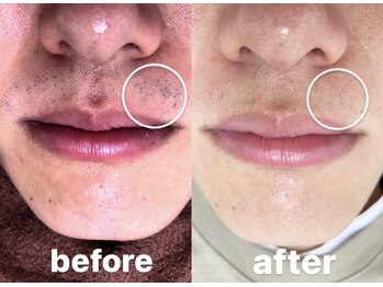 サロンド ユニバース(salon de universe)/