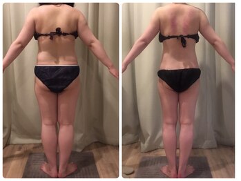 クランシュプール 恵比寿店/【肩こり/腰痛/満身創痍】