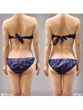 エキュロ 敦賀店(equro)/ノンFモンスター＋筋膜リリース