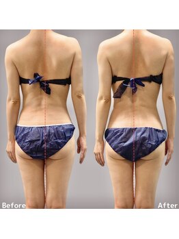 エキュロ 敦賀店(equro)/ノンFモンスター＋筋膜リリース