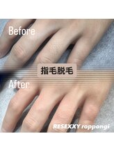 リゼクシー INTERNATIONAL麻布十番 六本木(RESEXXY)/指毛の脱毛