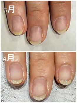 グレースレディ 神戸北店/