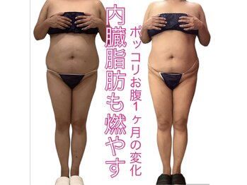 アールズ スリム(R's slim)/本格痩身・痩せたいをサポート