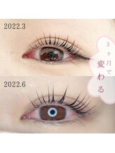 バニーアイズ 天神(Bunny eyes TENJIN)/ラッシュアディクト