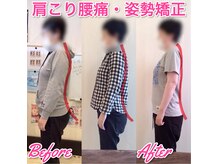 首コリ肩コリや腰痛を姿勢から根本的に改善いたします！