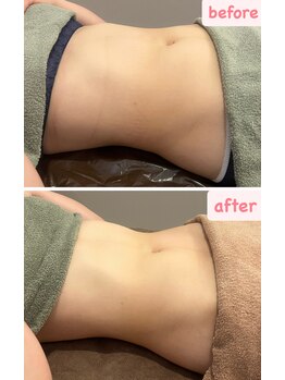 ユヴィラ(YUVIRA)/腸もみでお腹のガス張り解消！