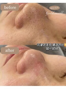 ゴールデンセル(golden cell)/