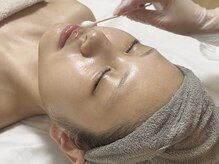 ピョル(pyoru)/ララピール施術工程