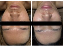 ビノスビューティー(vinos.beauty)/ReLABEAUTEタラソトリートメント