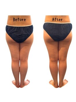 カリド ラボ(CALIDO LAB)/ヒップUP♪下半身90分スッキリ！