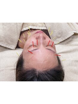 眼精疲労を解消したい