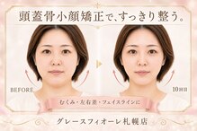 頭蓋骨 小顔矯正サロン グレースフィオーレ 札幌店(gracefiore)