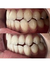 イイハキューブ(e8 cube)/before & after