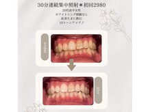 プラスビーセルフ(+b self)/ビフォーアフター