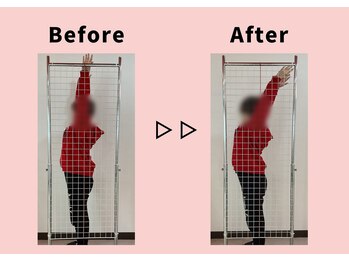 ストレッチヒーロー 加古川店/首コリで悩まれている方必見!