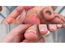 キラネイル アンド アイラッシュ by World Beauty(KIRA)/ペディグラス