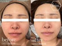 フェイン 青山店(fein.)/うるつや！どんなお肌の方でも◎