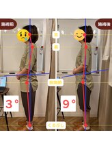 ふらっと/40代前半/接客業 肩こり