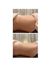 ナチュラリー(naturally)/腸セラピー