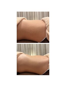 ナチュラリー(naturally)/腸セラピー