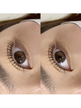 アンド シェリ(& Cheri)/メーテルロッド