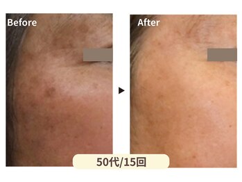 美男美女 奈良三条店/色むら解消へ