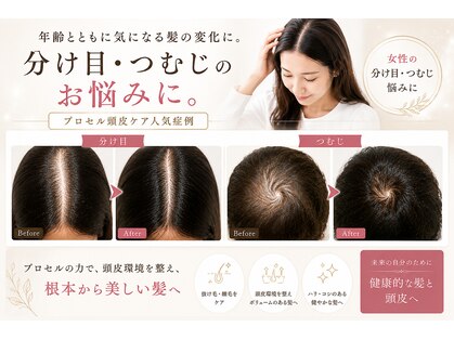 チル(Chill)の写真
