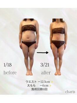 カリス(charis)/ブライダルエステ