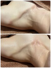 リノ(LINO)/首肩デコルテのスッキリ感