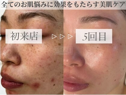 エリス(ELISSE)の写真