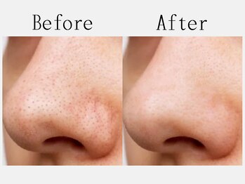 ゴールデンケア 岡崎店(Golden Care)/シミ・毛穴洗浄・フェイシャル