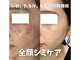 ドットフェイス(.Face)の写真