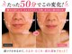 シャンティ(shanty)の写真