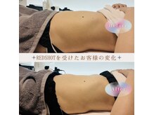 アンドユー(&U)の雰囲気（《本気痩身結果例》脂肪分解・筋トレ・代謝アップが同時に叶う）