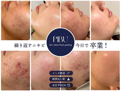 ピブ(PIBU)の写真