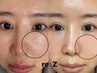 1回で劇変！ダイヤの力で毛穴レスの【水光肌】を実現☆最先端の韓国美容術♪