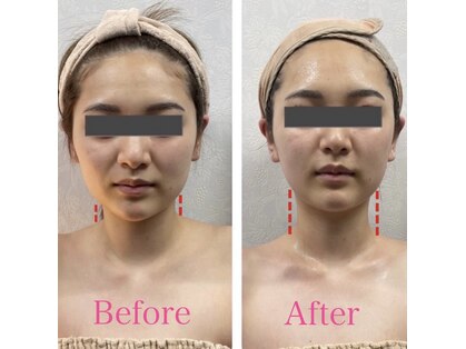 TKC 東京小顔センター五反田店の写真