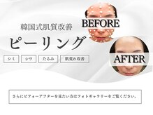 カナロア 宇都宮店(Kanaloa)