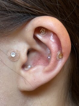 みすみ治療院/今日の耳ツボジュエリー8/7