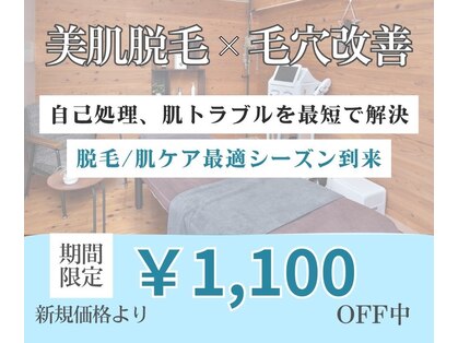 サンテ(Sante)の写真