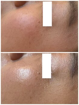 リノ(lino)/うるツヤ肌へ